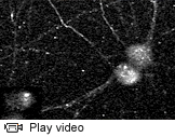 Pseudorabies virus particles video