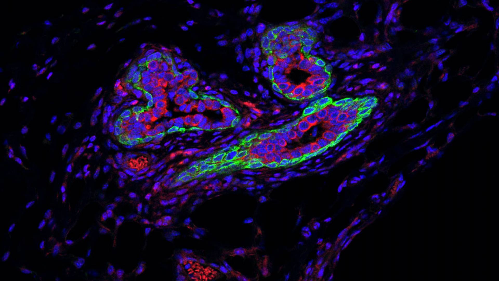 microscopic image shows different cell types in the normal mammary ducts of a mouse