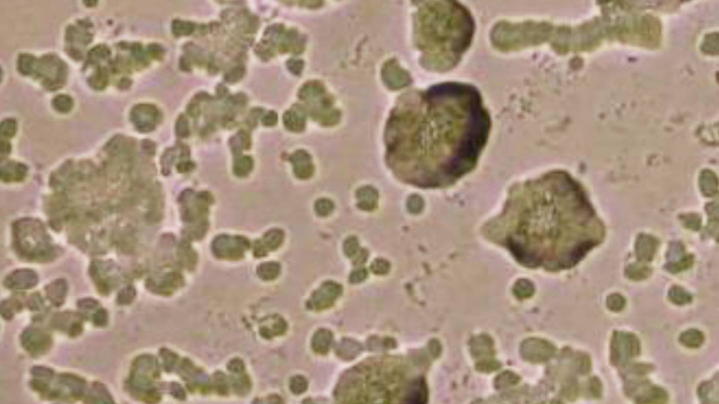 slime molds connecting