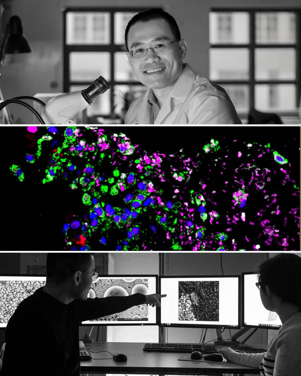 Stack of photos showing Ybin Kang, a microscopic image of cancer cells, and researchers in Kang's lab.