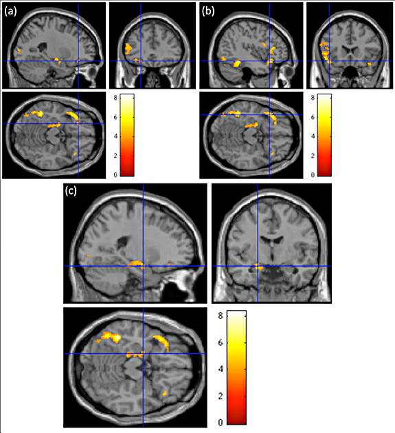 metaphor_brainscan_575