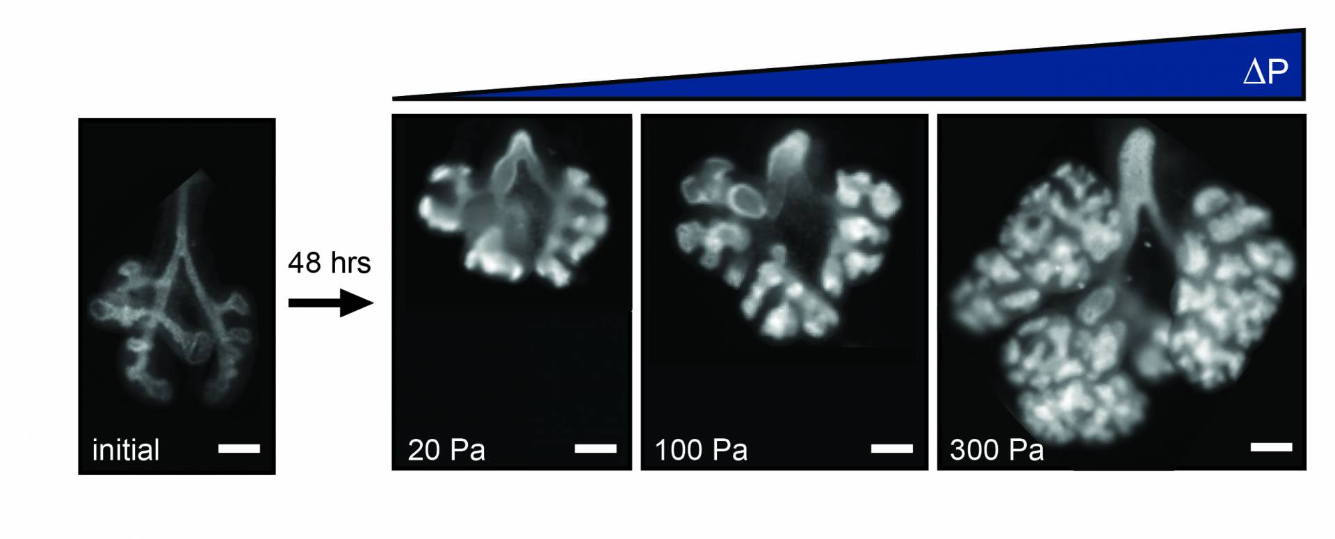 Graphics of developing lungs showing effects of fluid pressure